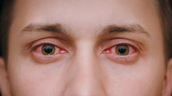 mắt tổn thương do dùng thuốc