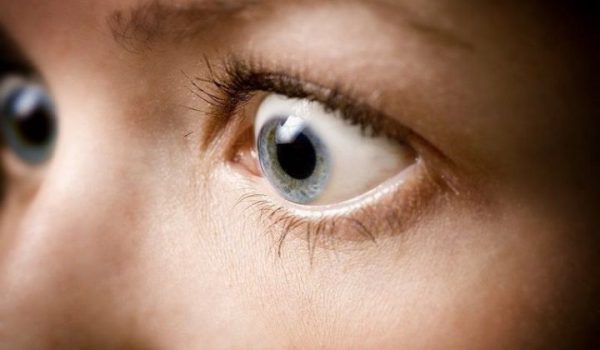 Bệnh lồi mắt là tình trạng nhãn cầu bình thường bị đẩy ra trước do tăng thể tích tổ chức trong hốc mắt