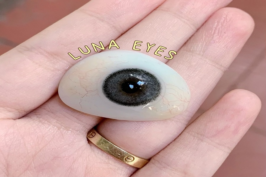 Phẫu thuật lắp mắt giả những điều nhất định bạn phải biết