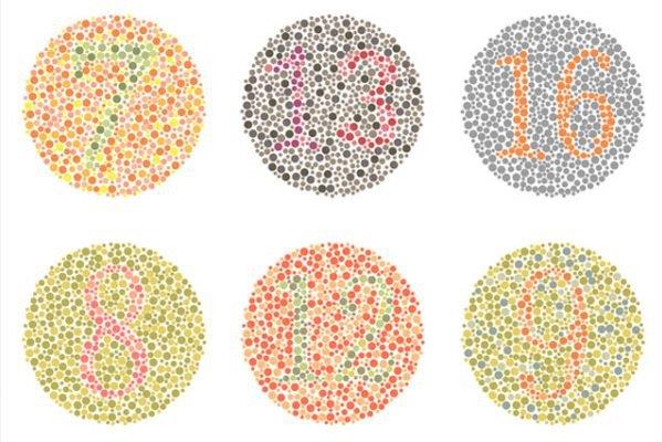 Dấu hiệu nhận biết bệnh mù màu là bệnh không phân biệt được một số màu sắc nhất định như đỏ, xanh lá