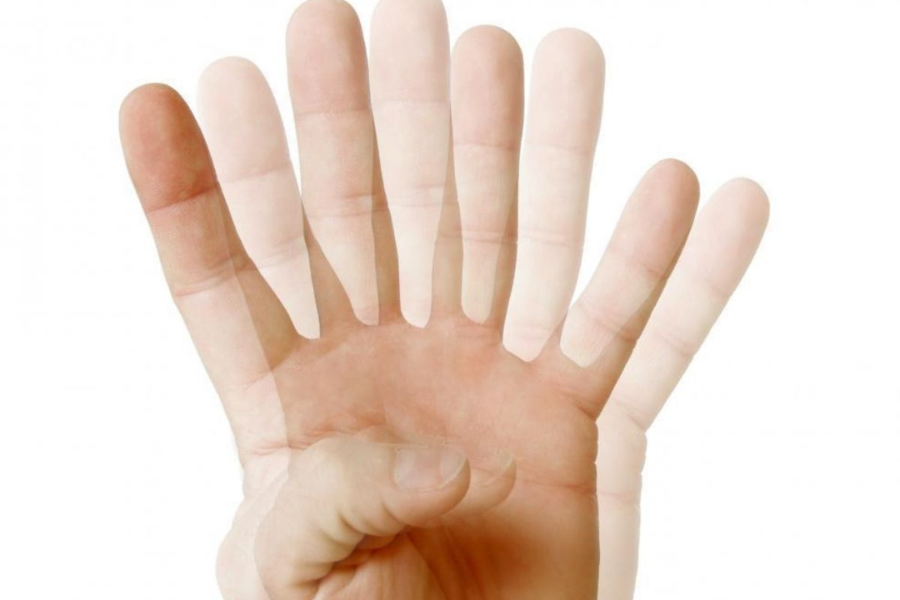 Số ít bệnh nhân mắc u hốc mắt sẽ có triệu chứng nhìn đôi