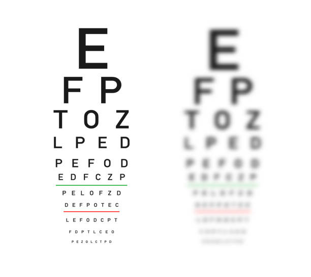 Cận thị 1 bên mắt nếu không được điều chỉnh sớm có thể dẫn đến suy giảm thị lực