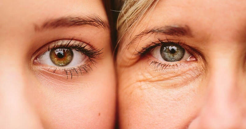 Da mắt bị trùng, nhão có thể cải thiện được bằng các phương pháp thẩm mỹ